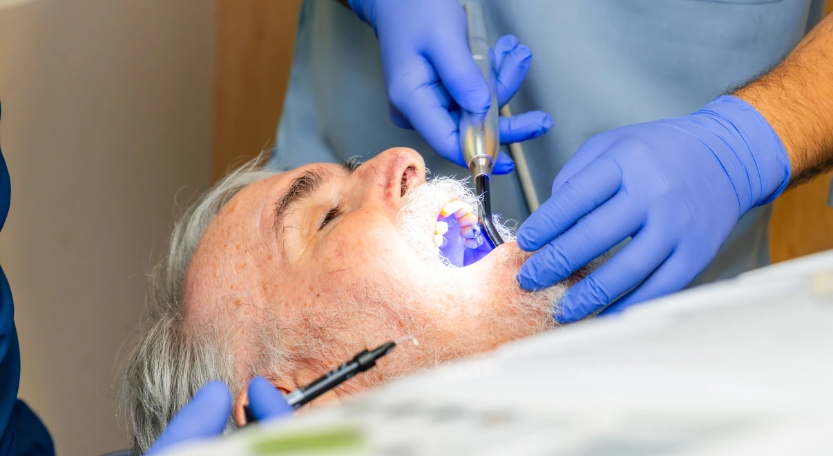 Dentista reconstruyendo un diente con una resina dental más grande.