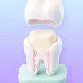 Root-canal-treated tooth icon for crown evaluation.