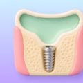3D icon showing bone volume and sinus anatomy for implant planning.