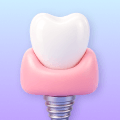 3D icon showing soft tissue around a dental implant.