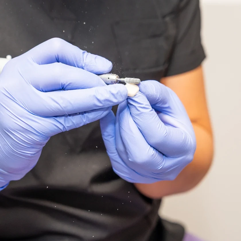 Close-up of a dental crown being shaped at hisonrisa in Roma Sur, Mexico City.