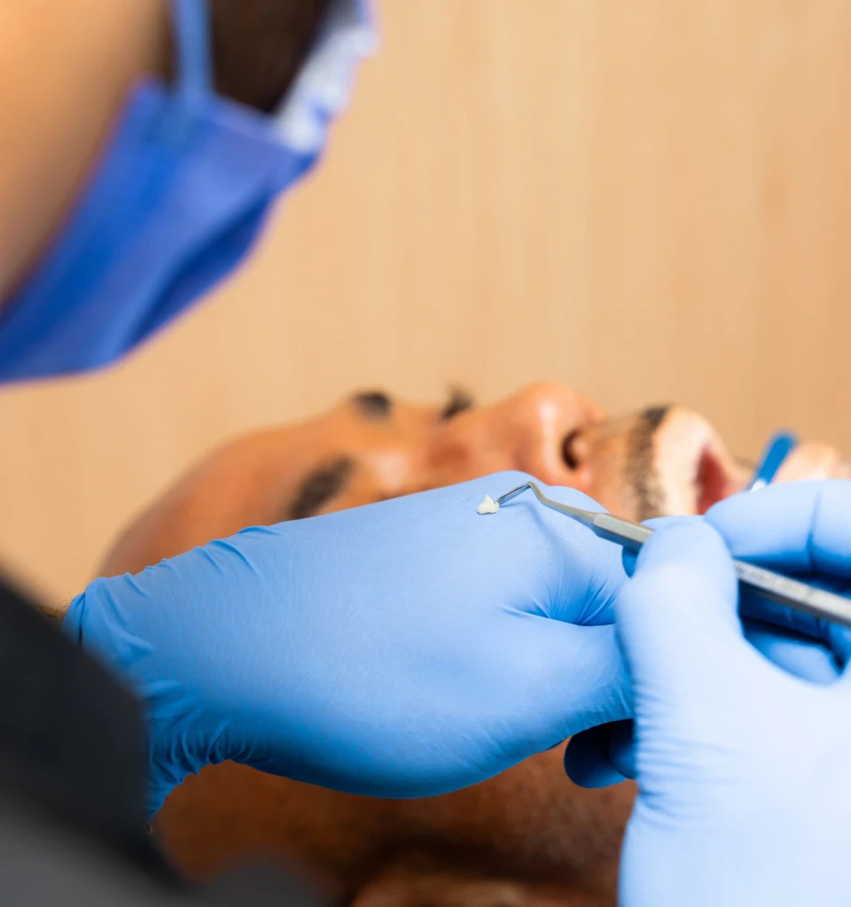 Dentist preparing a tooth repair during a restorative appointment.