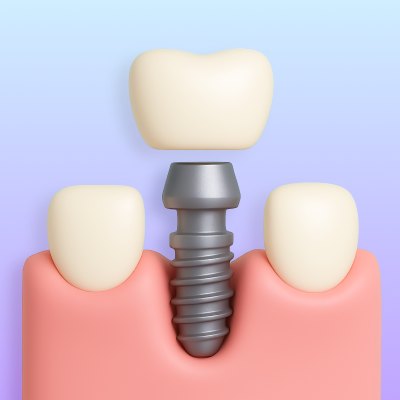 Go to dental implants treatment page