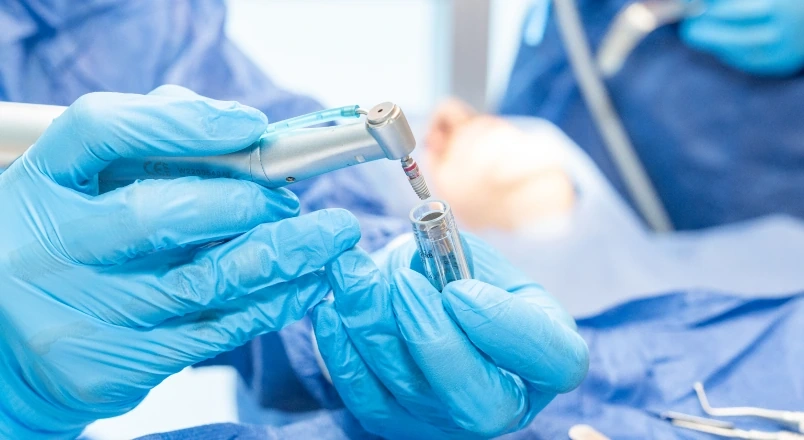 Dental team preparing an implant during treatment planning.