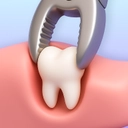 Wisdom tooth extraction icon with forceps removing a molar.