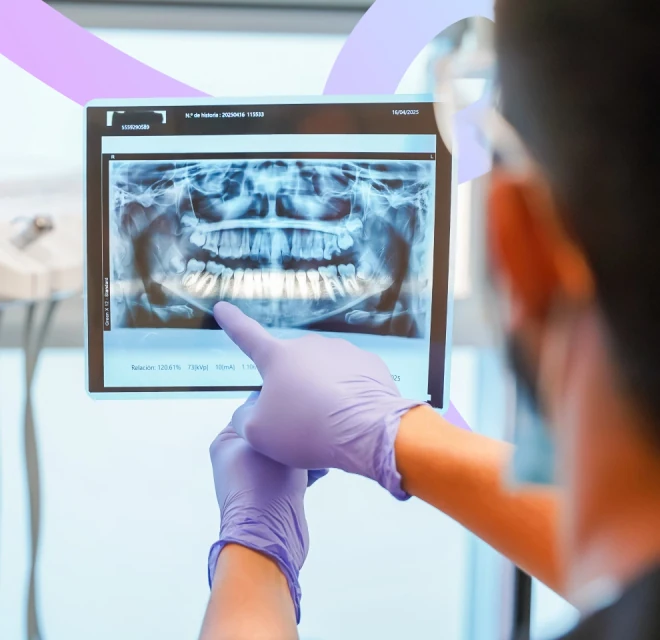 Dentist reviewing a panoramic X-ray for wisdom tooth extraction in Mexico City.